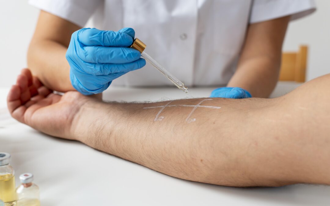 I test allergometrici rappresentano uno strumento diagnostico indispensabile per scoprire o confermare la presenza di allergie.